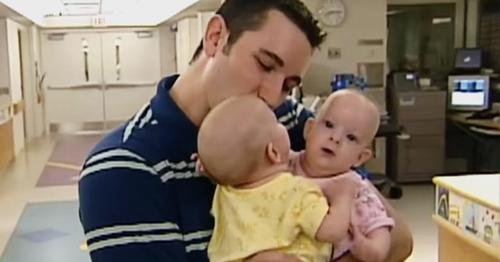 Conjoined Twins Who Were Separated Through Surgery Almost 18 Years Ago Are Living Life Like Normal Teenagers Today