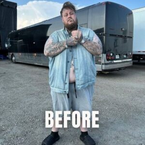 Jelly Roll lost over 100 pounds while fighting food addiction battle Jelly Roll lost over 100 pounds while fighting food addiction battle
