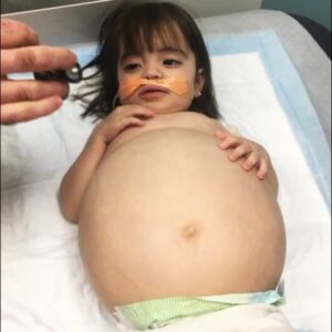 Little girl gets life-saving kidney operation thanks to her dad Little girl gets life-saving kidney operation thanks to her dad