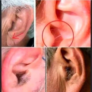 Did you know that if your ear hairs grow, it is because your body is Did you know that if your ear hairs grow, it is because your body is