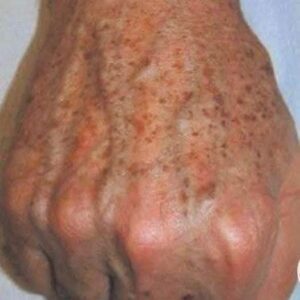 Did you know that if you get STAINS on your HANDS it’s because you have… Did you know that if you get STAINS on your HANDS it’s because you have…