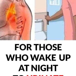 Excessive Urination: Causes, Symptoms, and When to Worry Excessive Urination: Causes, Symptoms, and When to Worry