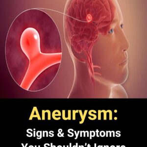 Aneurysm: Symptoms You Shouldn’t Ignore Aneurysm: Symptoms You Shouldn’t Ignore